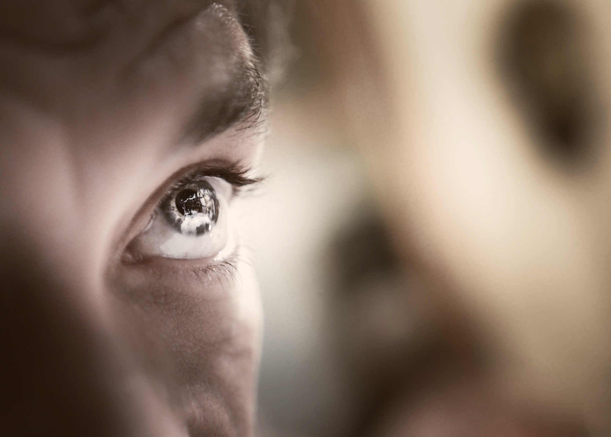 Glaucoma